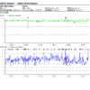 Strip Chart Report visualization from ToronTek-B400, offering an alternative view of sleep study outcomes