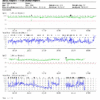 Full Study Report from ToronTek-B400 illustrating event occurrences and sleep patterns over a detailed timeline