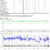 Detailed Oximetry Report from ToronTek-B400 displaying in-depth analysis of SPO2 occurrences over time