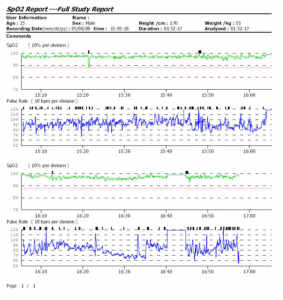 Full Study Report from ToronTek-E400W Pulse Oximeter detailing SPO2 and pulse rate data over time.